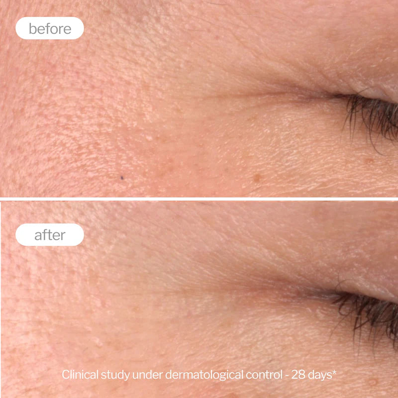 Novexpert Pro-Collagen Booster Serum – Serum za Podsticanje Kolagena