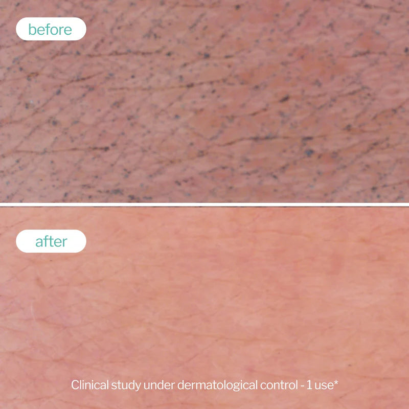 Novexpert Clear Skin pena za umivanje – čišćenje za masnu i problematičnu kožu