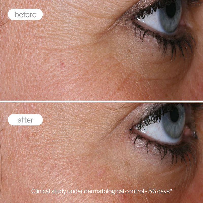 Novexpert Expert Anti-Aging krema – intenzivna nega protiv bora za suvu kožu
