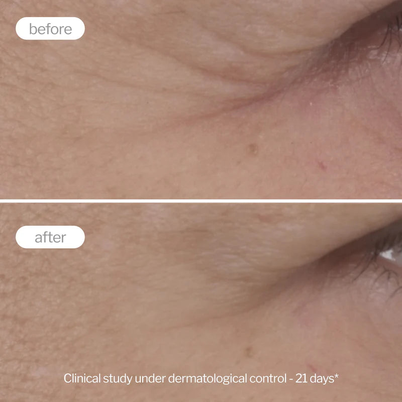 Novexpert Expert Anti-Aging krema za zonu oko očiju – Protiv bora, podočnjaka i otečenosti