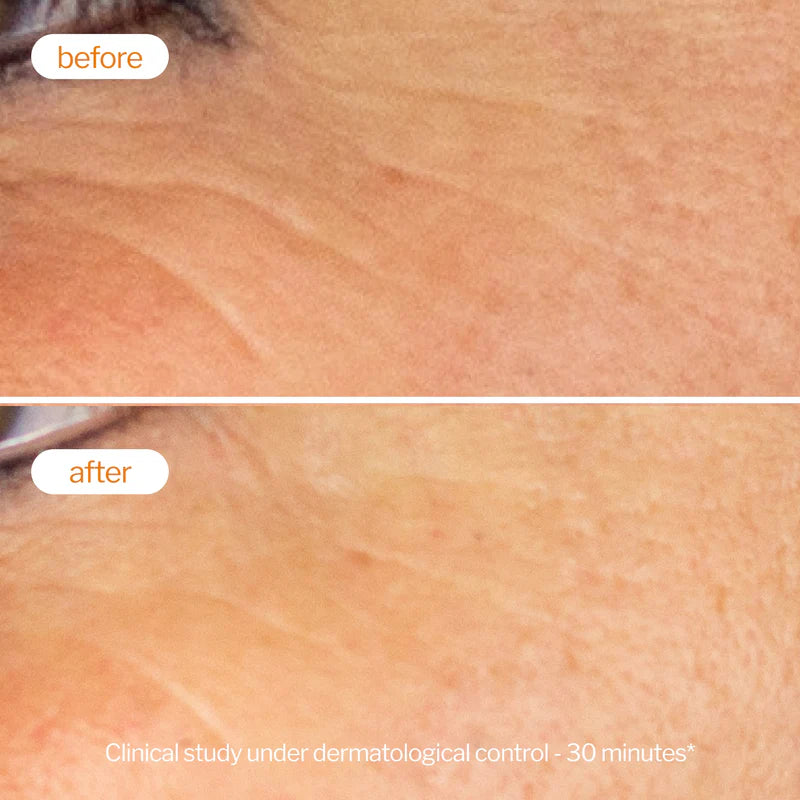 Novexpert Booster serum sa vitaminom C – 25% stabilizovanog kompleksa