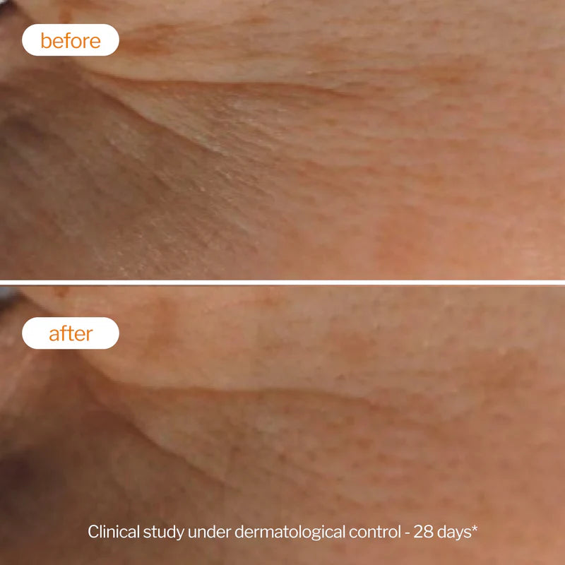 Novexpert Vitamin C Radiance Piling – Za Blistaviji, Glađi i Ujednačeniji Ten