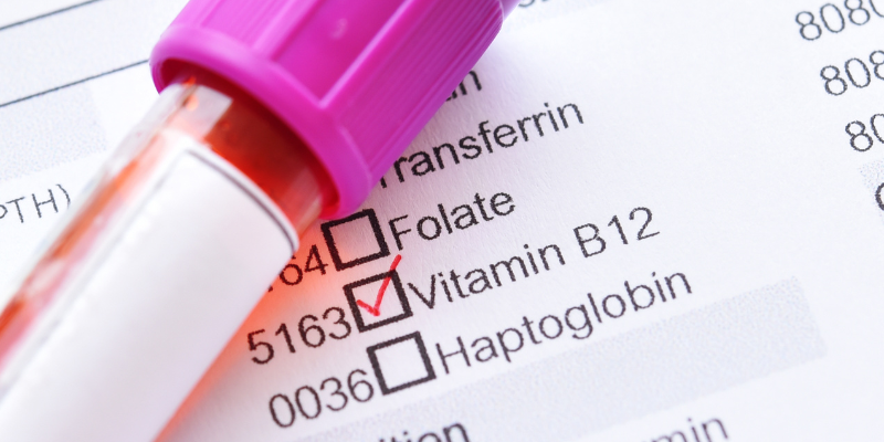 Vitamin B12: Neizostavni nutrijent za energiju, mozak i krvnu sliku