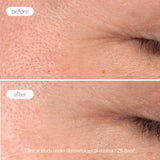 Novexpert Pro-Collagen Booster Serum – Serum za Podsticanje Kolagena