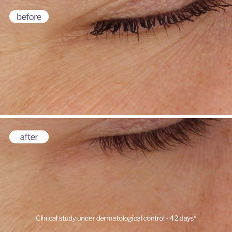 Novexpert Pro-Retinol Dual Booster Serum – Revolucija protiv bora