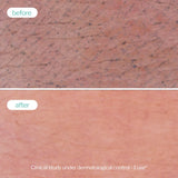 Novexpert Clear Skin pena za umivanje – čišćenje za masnu i problematičnu kožu