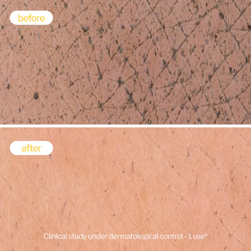 Novexpert 5-u-1 ulje za čišćenje lica sa 5 Omega – Nega i zaštita