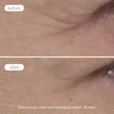 Novexpert Expert Anti-Aging krema za zonu oko očiju – Protiv bora, podočnjaka i otečenosti