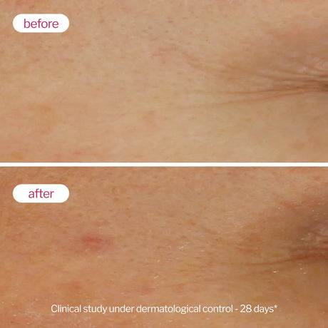 Novexpert Booster serum sa hijaluronskom kiselinom 3,2% – Ultra hidratacija