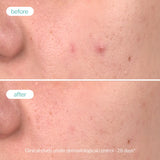 Novexpert Clear Skin piling serum – Dupla obnova za čist ten, manje nesavršenosti i anti-age efekat