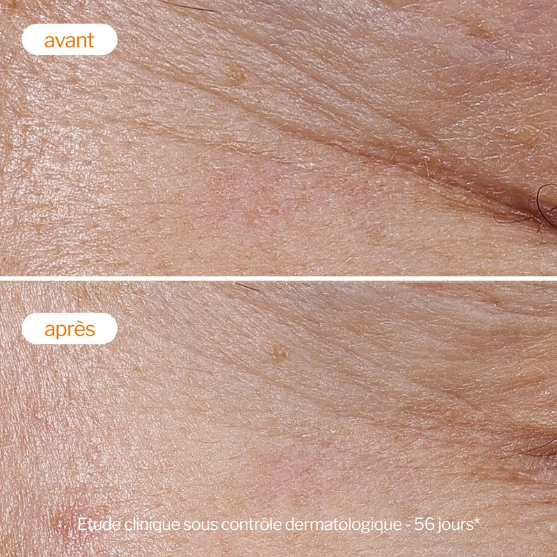 Novexpert Lagana Krema sa Vitaminom C – Hidratacija, Sjaj i Anti-Age Nega